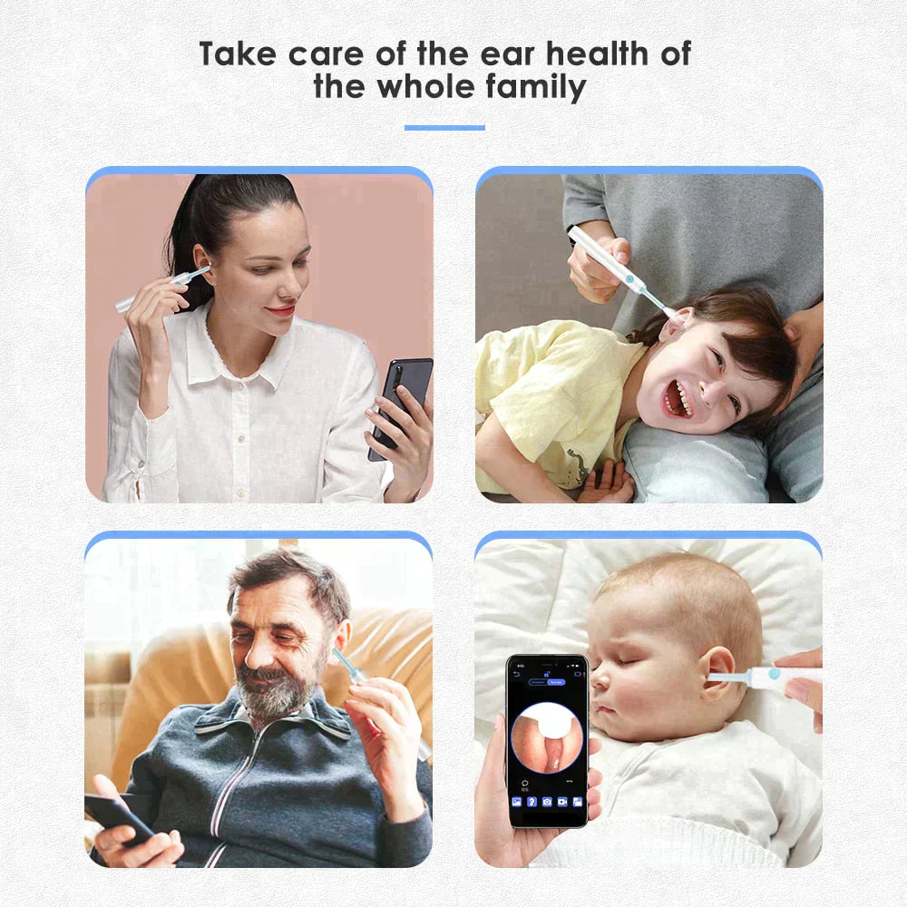 LUMINARA - EAR WAX REMOVER PRO