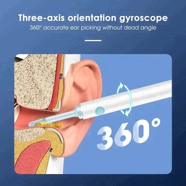 LUMINARA - EAR WAX REMOVER PRO