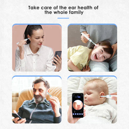 LUMINARA - EAR WAX REMOVER PRO